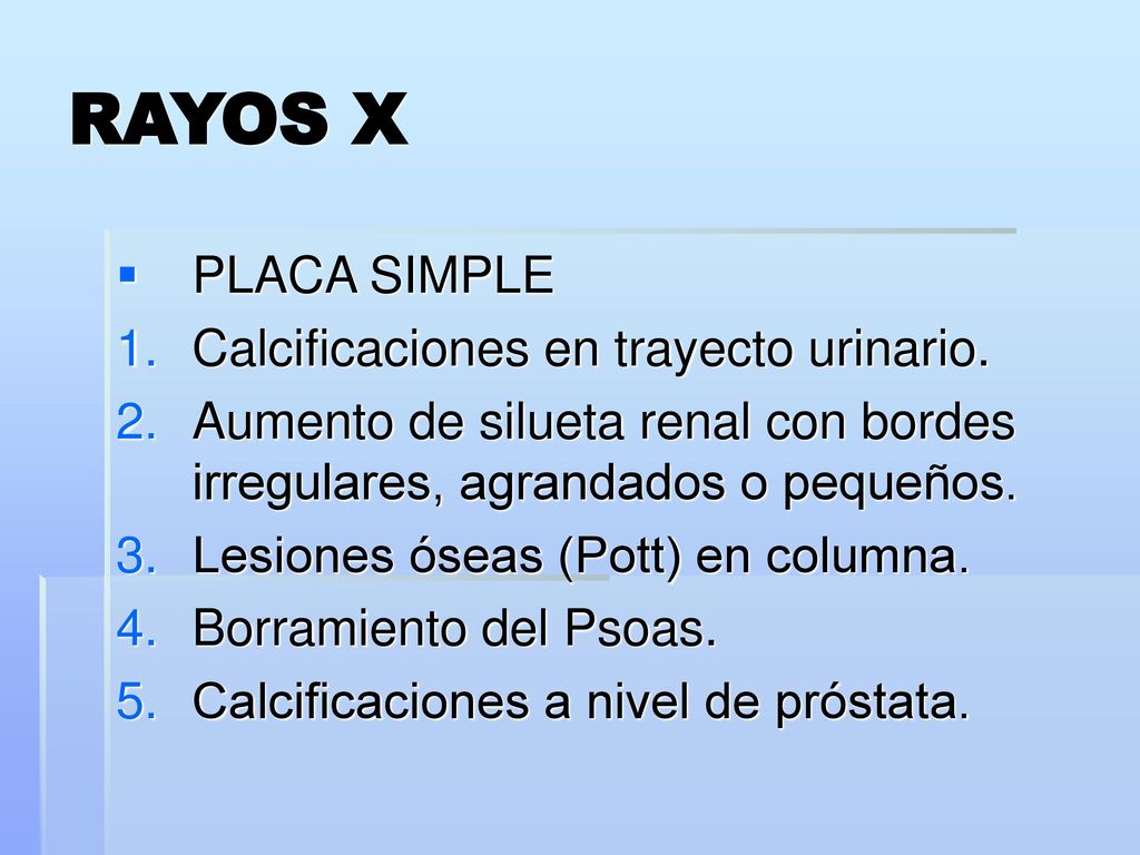 calcificaciones de próstata lo que son 2 años